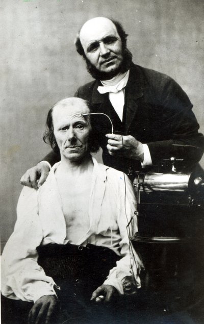 Duchenne de Boulogne mit einem Opferpatienten, 1862 von French Photographer